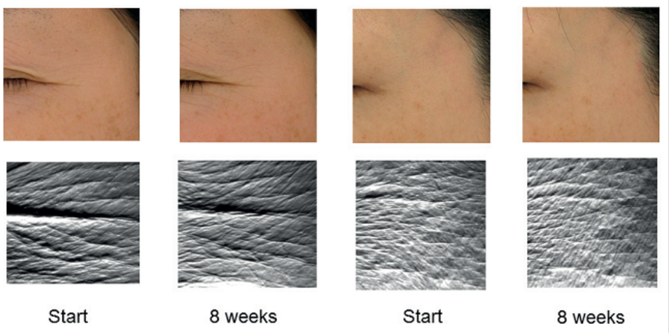 艾詩特蝦青素 艾詩特蝦青素