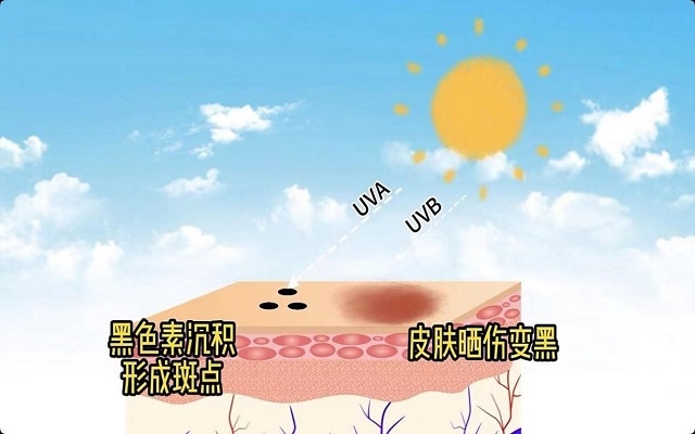 天然蝦青素可以祛斑嗎？